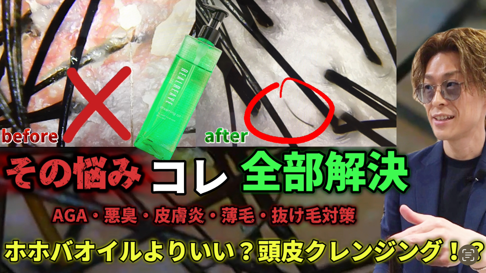 そのシャンプー、逆効果かも！？抜け毛・薄毛の原因は洗いすぎだった！？