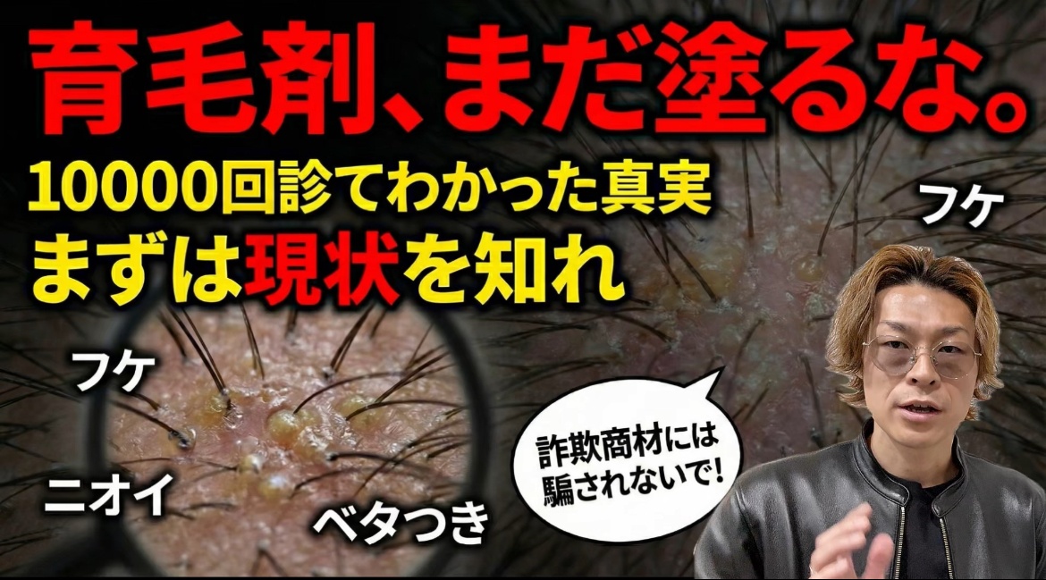 【40代・50代必見】毎日シャンプーしても臭う・抜ける…その原因は「皮脂の酸化」かも？