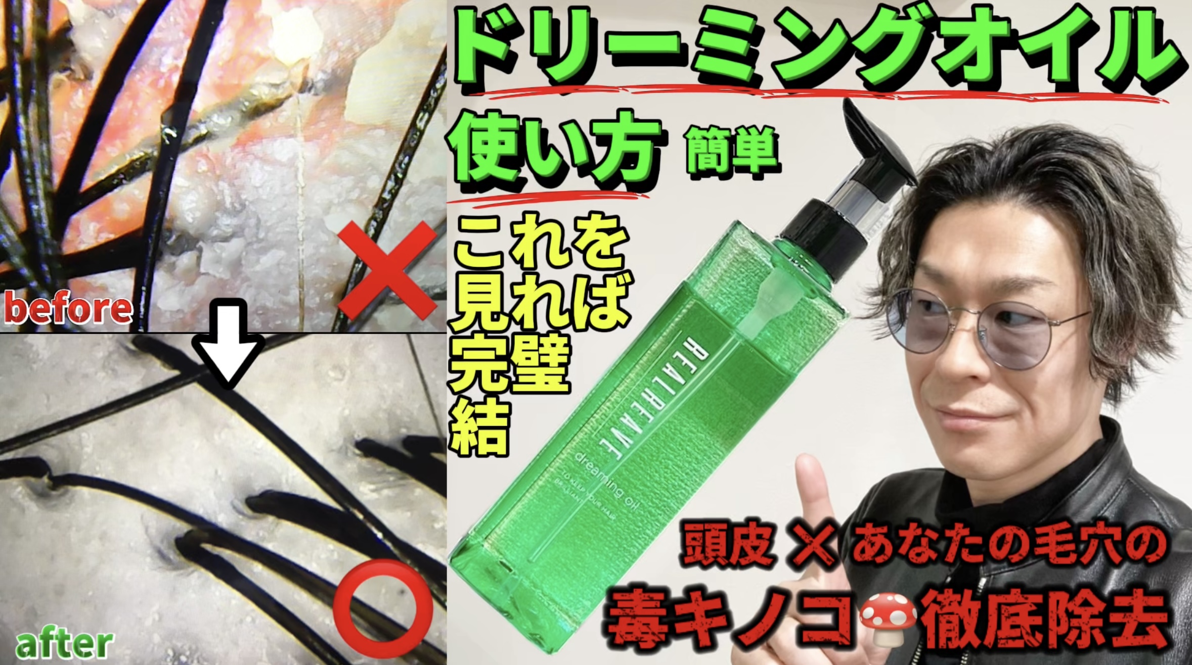 【悪質業者に注意】薄毛治療の闇を暴く！金ドブ回避の絶対法則！