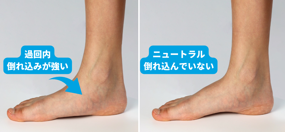 足・膝・腰の痛みの原因は 「足首の倒れ込み」