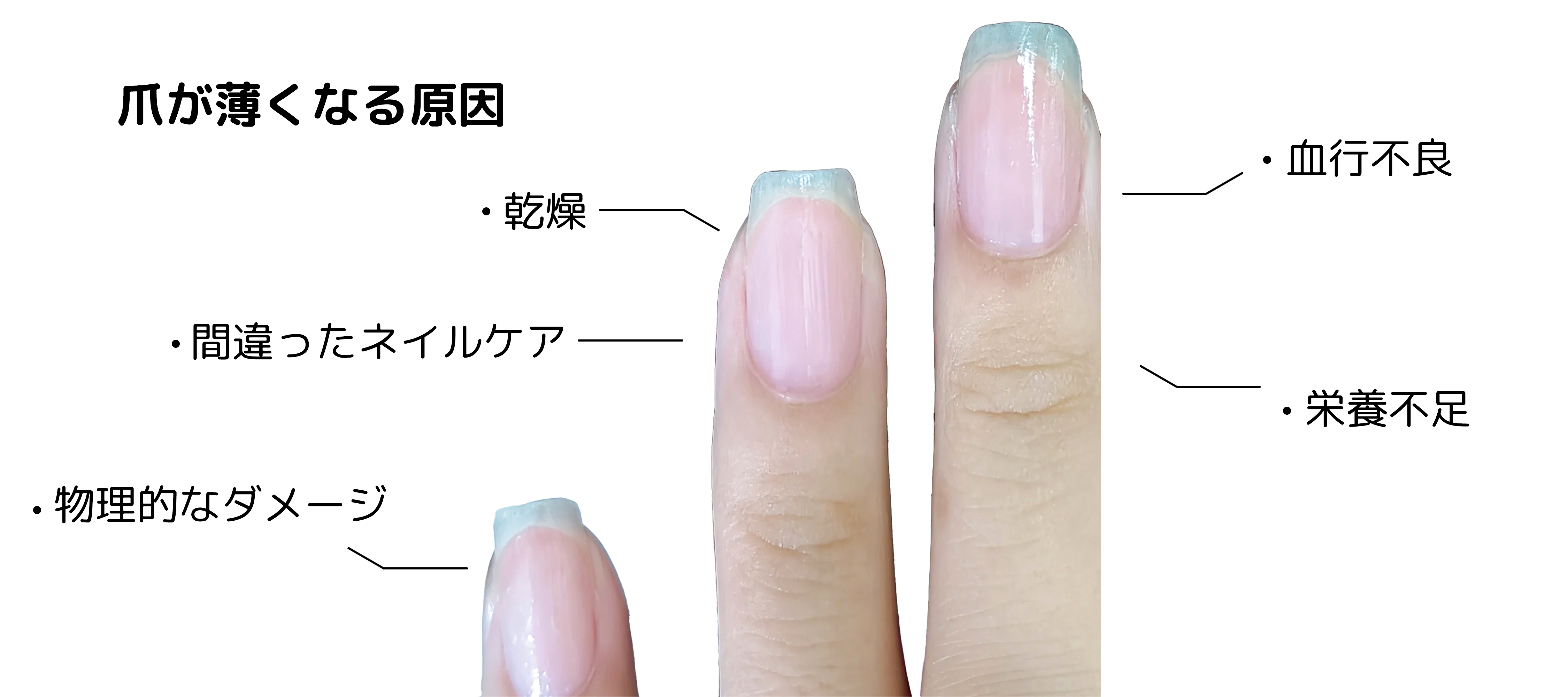 爪を強くするには？弱くなる原因と強くするためにできること