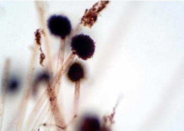 発酵食品の世界へようこそ🍶麹と味噌の深い関係