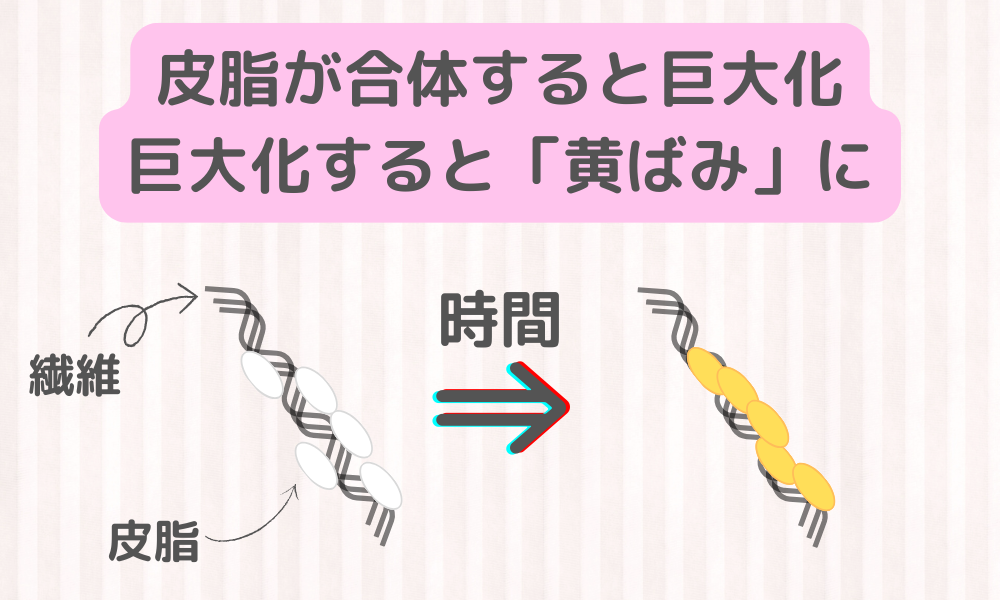 【本気の黄ばみ取り（全３回）】第１回：黄ばみはなぜ落ちにくい？　合体＆巨大化する皮脂