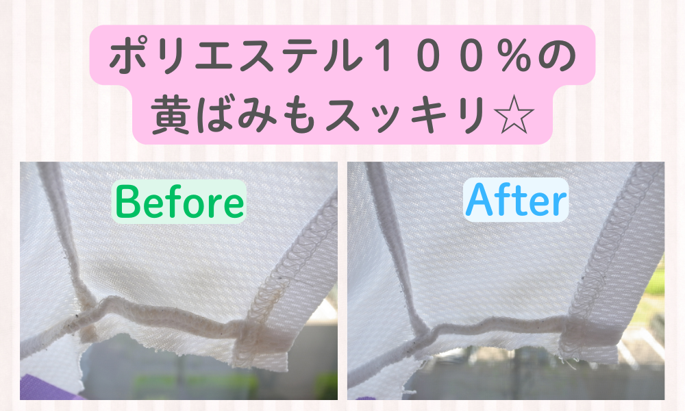 綿だけではなく、ポリエステル１００％の＂黄ばみ＂もスッキリ☆
