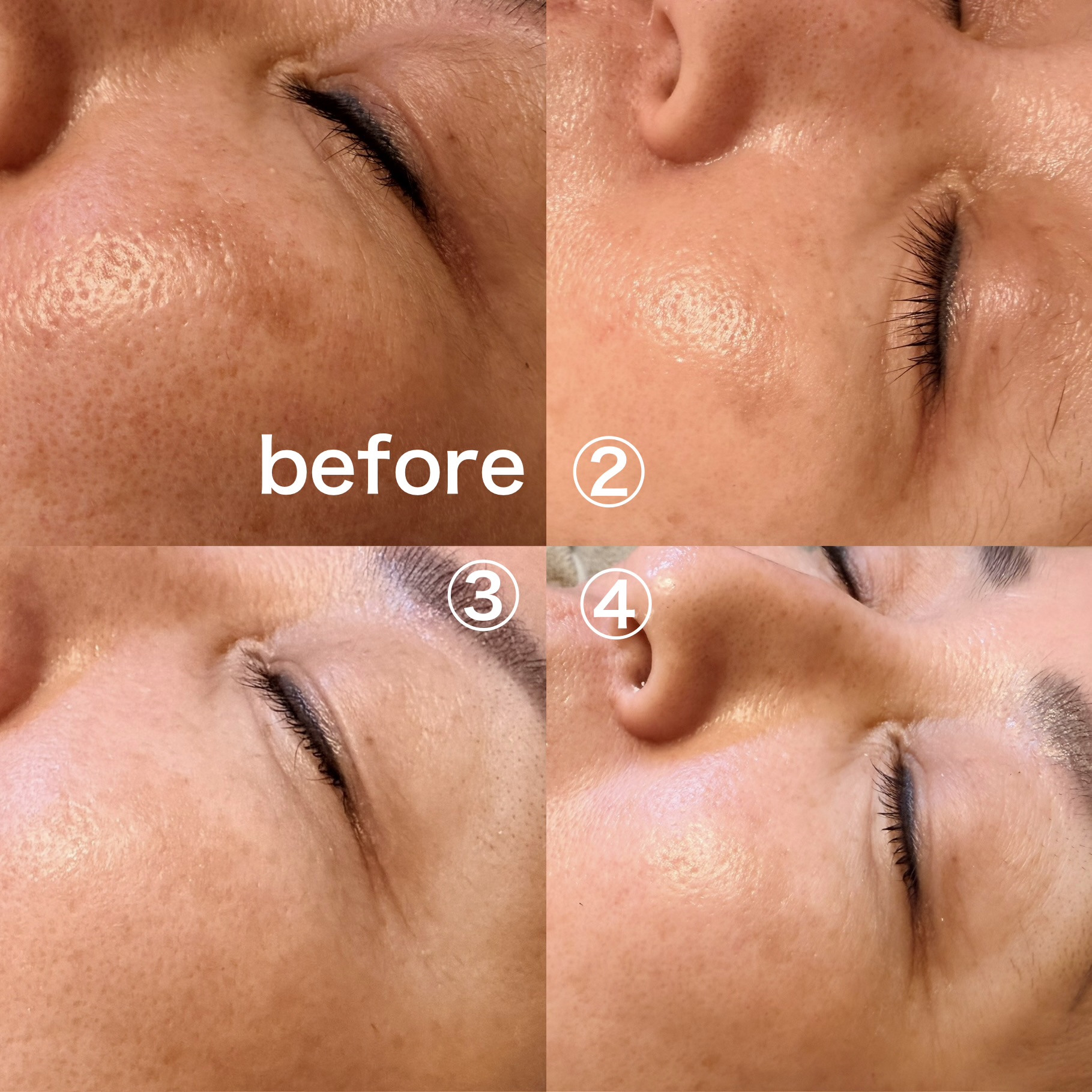 韓国美肌管理🇰🇷