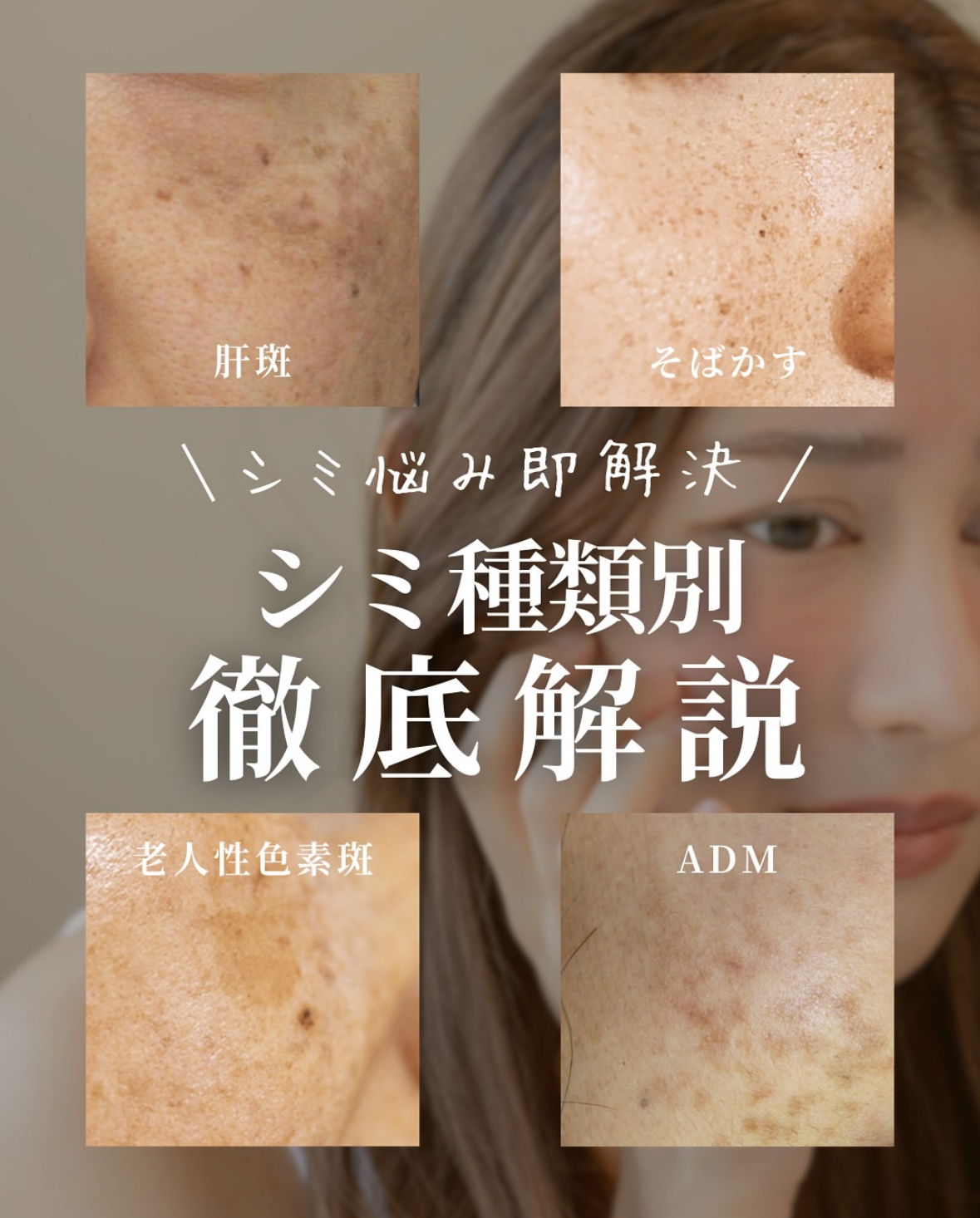 ＼シミ別徹底解説／