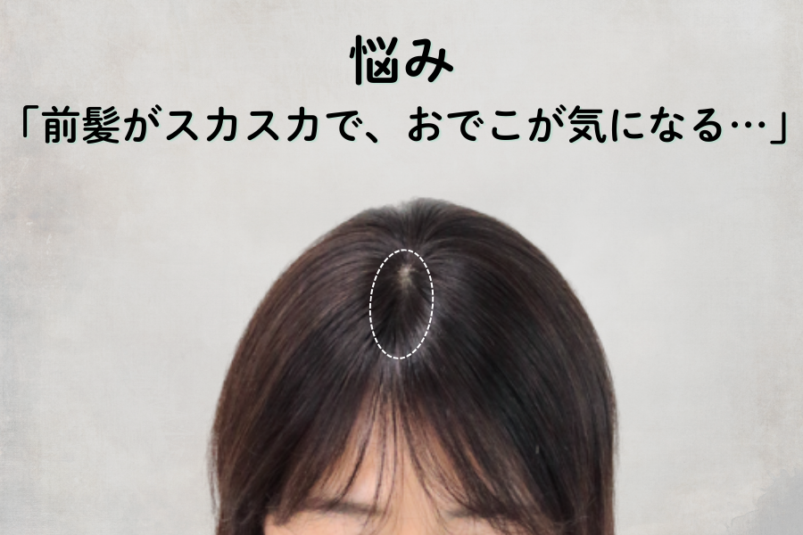 前髪が薄い…を“自然に”整える。あなたに合う対策ウィッグをご提案