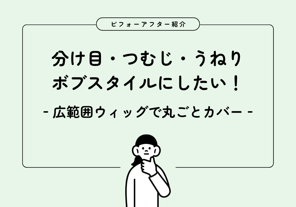 分け目・つむじの薄毛+うねりを同時解決!広範囲カバーウィッグのビフォーアフター
