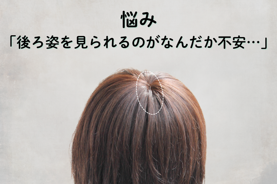 つむじの割れが気になる…自然に整えるかんたん対策