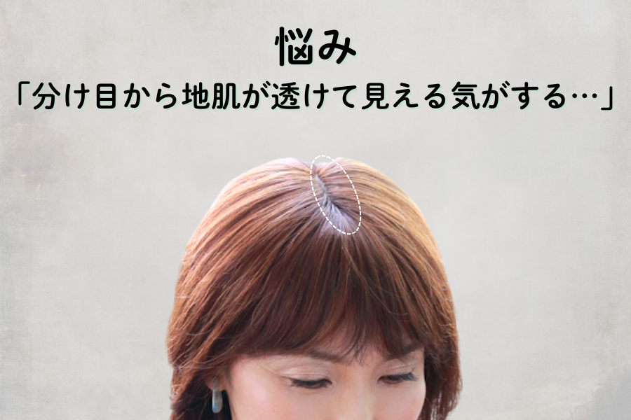 分け目が目立つ原因と対策｜自宅でできる工夫とウィッグの活用