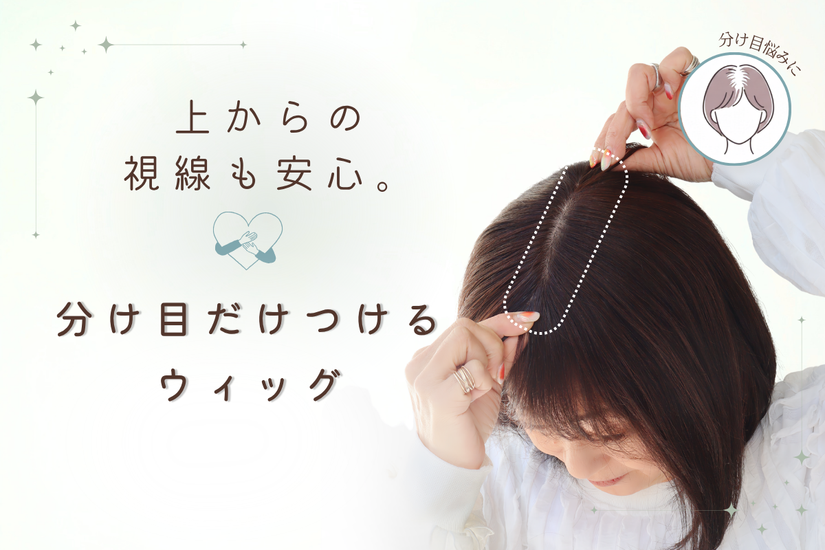 上からの視線も、もう気にならない。「分け目だけつけるウィッグ」という新習慣