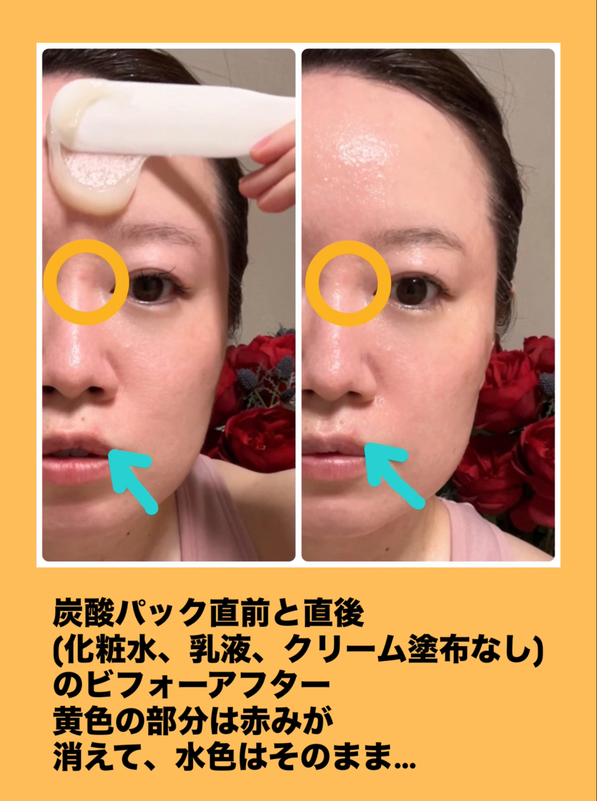 炭酸パックのやり方動画を作った（ビフォーアフター写真です）