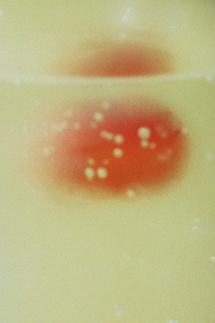 なぜ「マヌカ」は口内環境ケアに注目されるのか