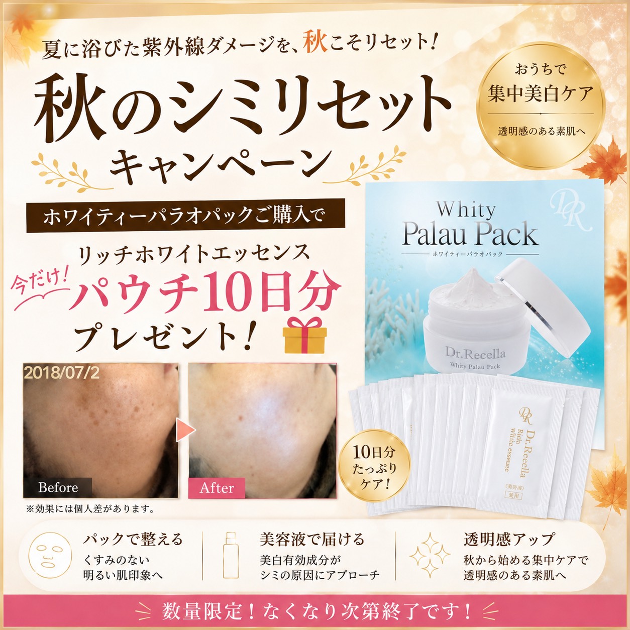 【秋のシミリセットキャンペーン】秋の美白ケアセット