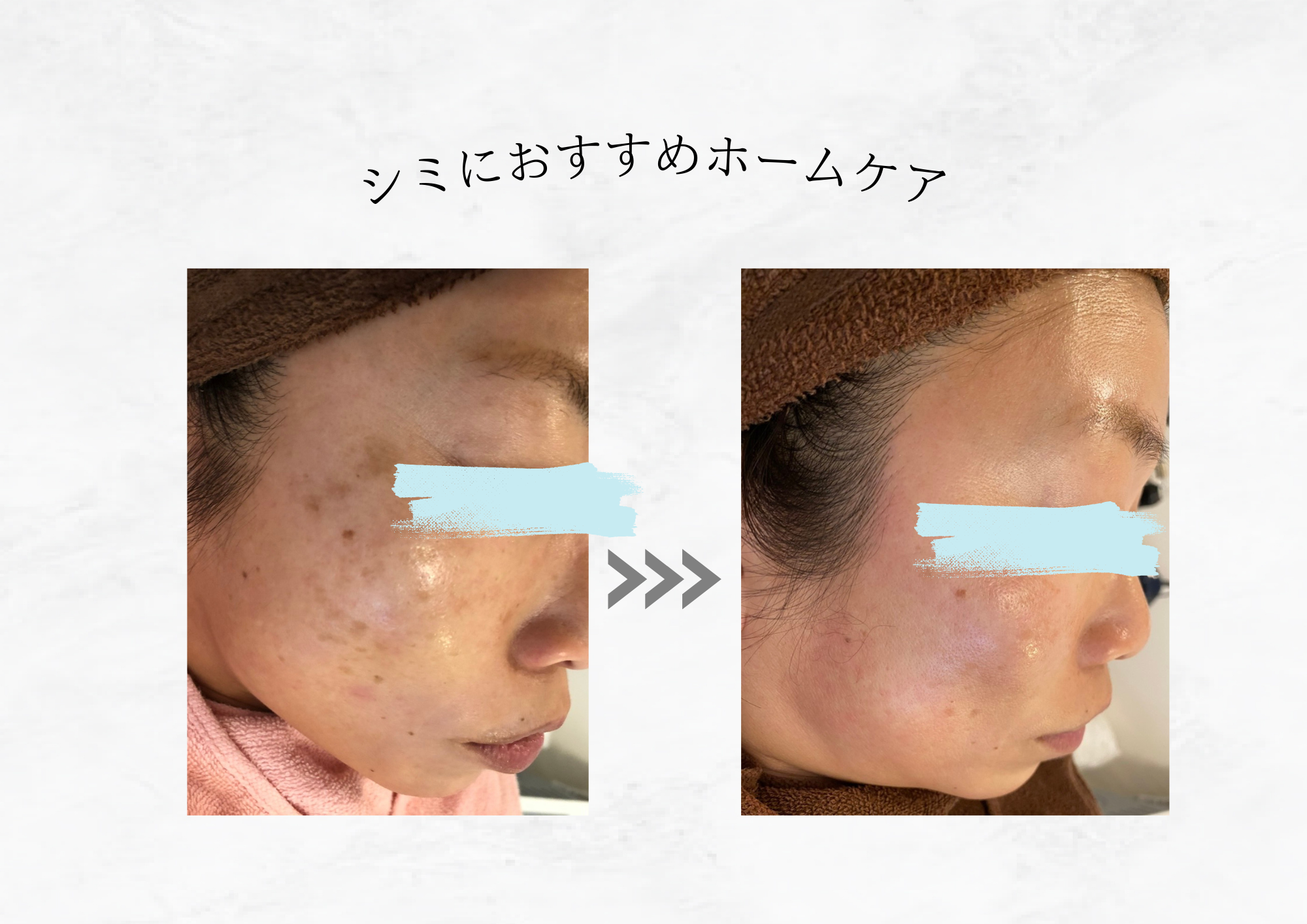 【続けられる習慣を取り入れよう】シミケアのホームケアでできること