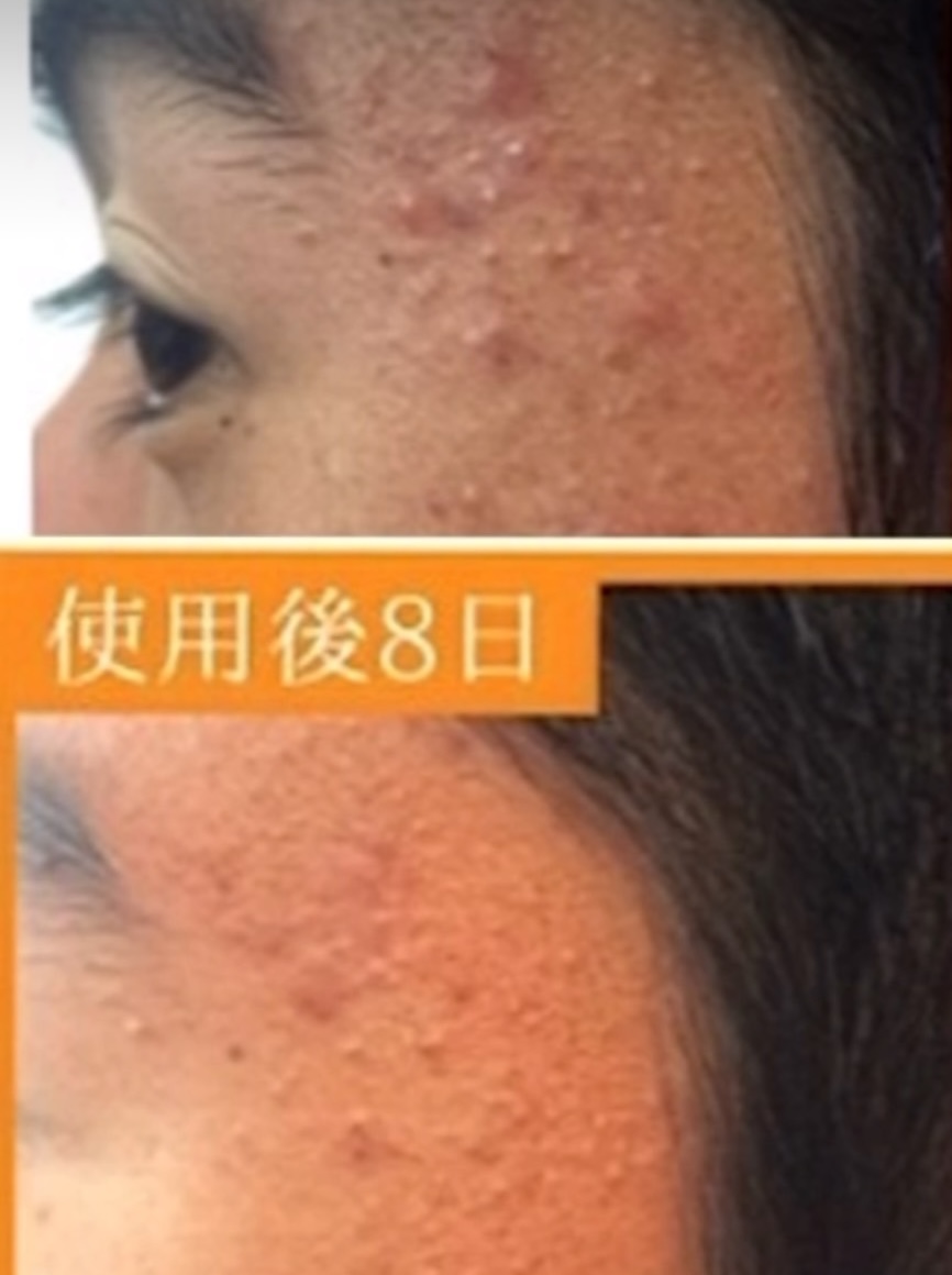 【スキンケアは老若男女関係なし】部活男子のための簡単スキンケア習慣