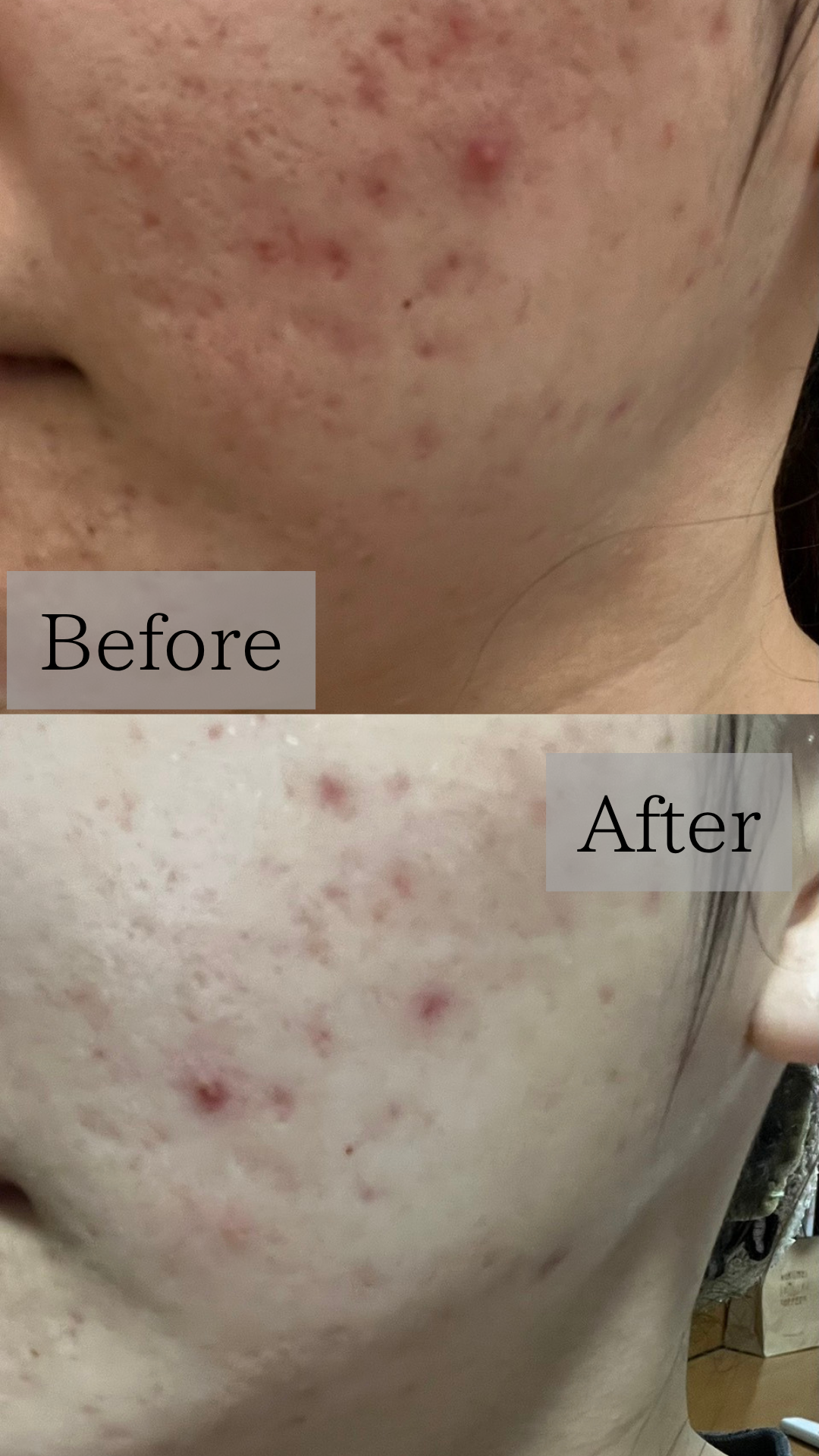 【 ミヴェール バークセラムで“肌体力”を取り戻す 】半年間の再生プログラム