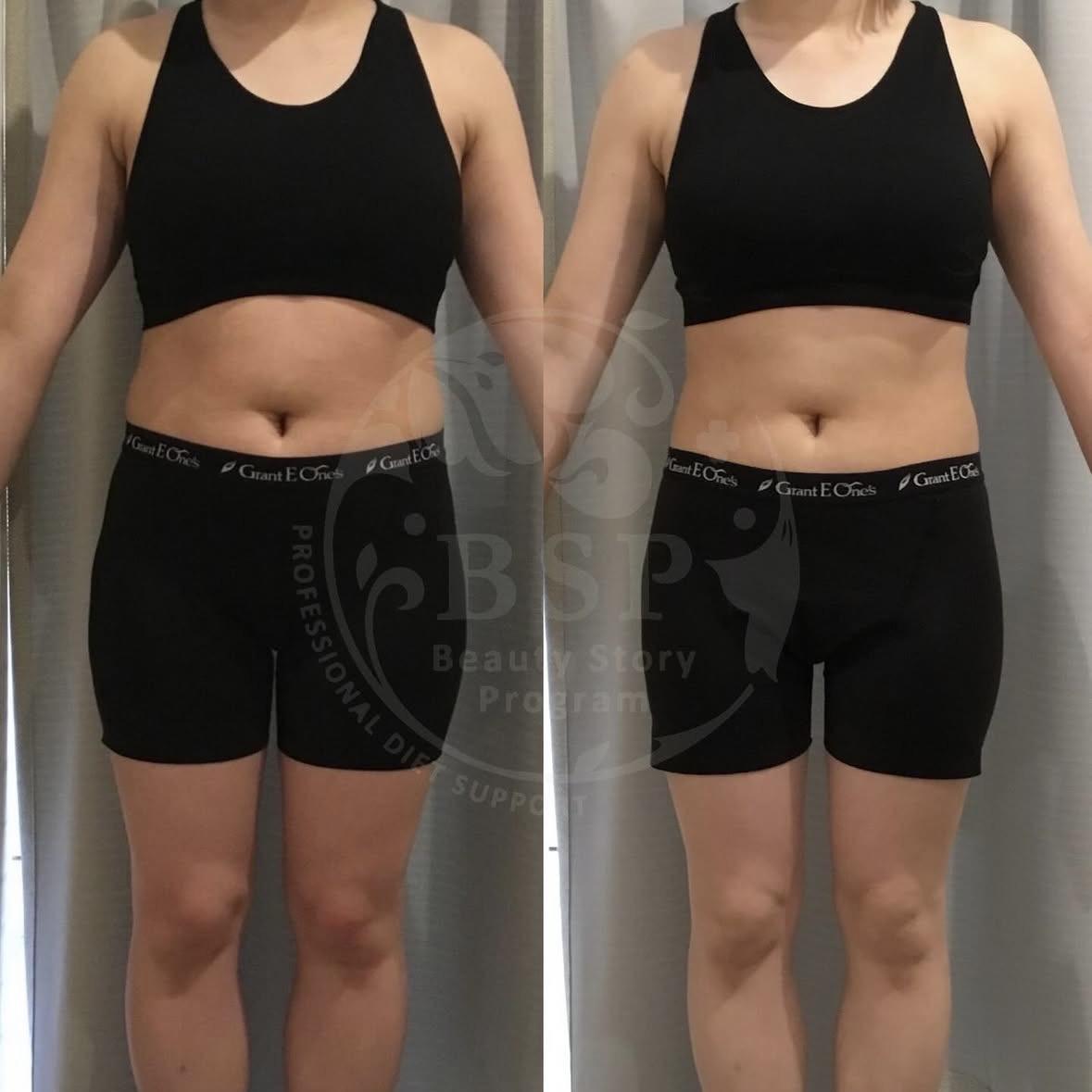 旅行前に“人生いちばんキレイな私”へ