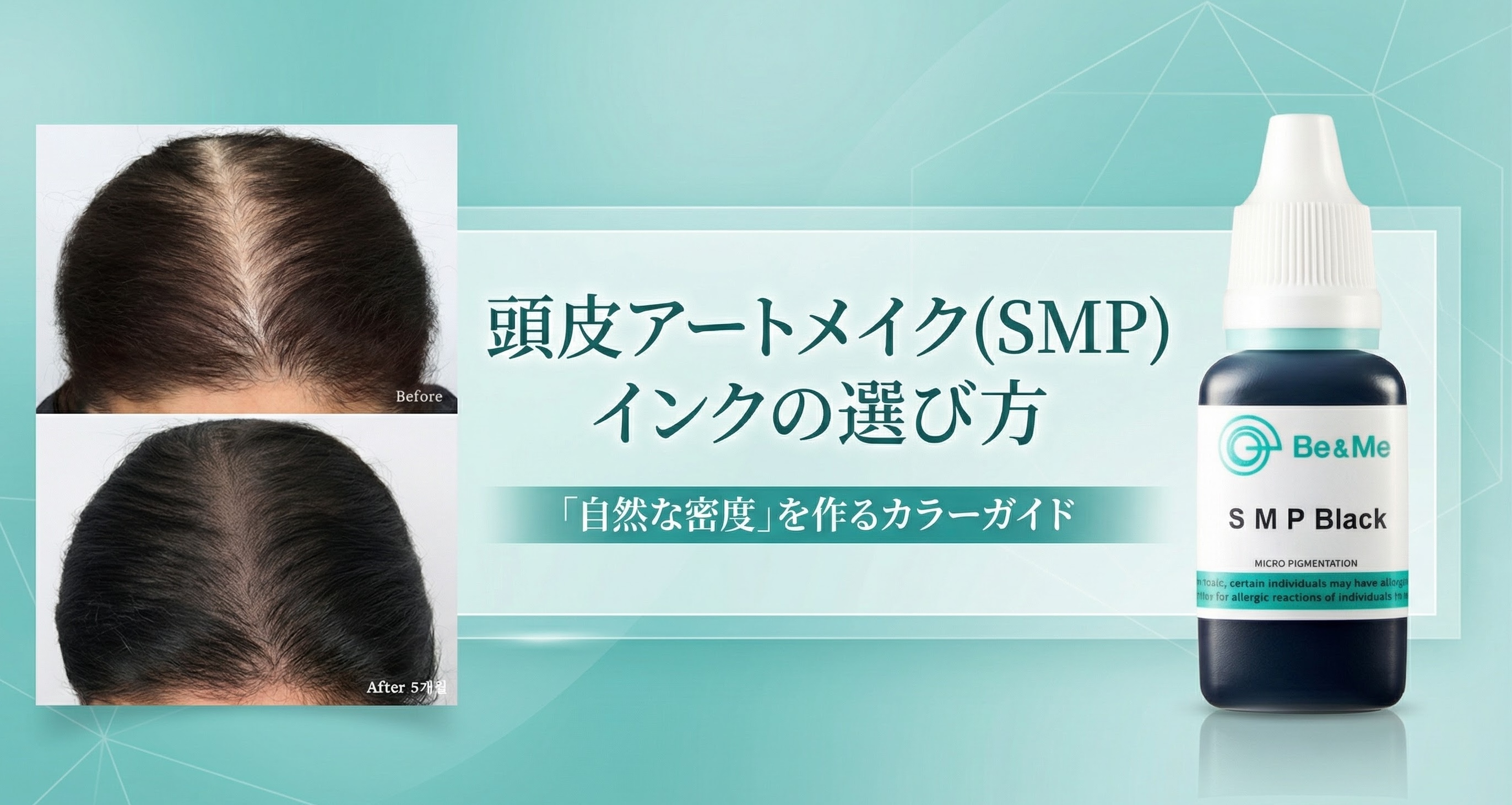 頭皮アートメイク（SMP）インクの選び方｜「自然な密度」を作るカラーガイド