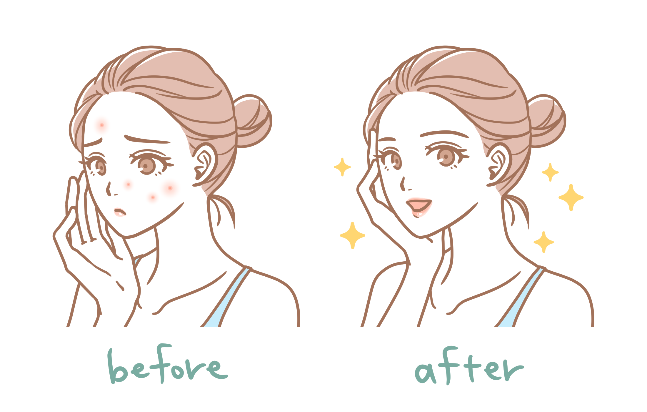 光フェイシャルで“くすみ払い”の年末ケア