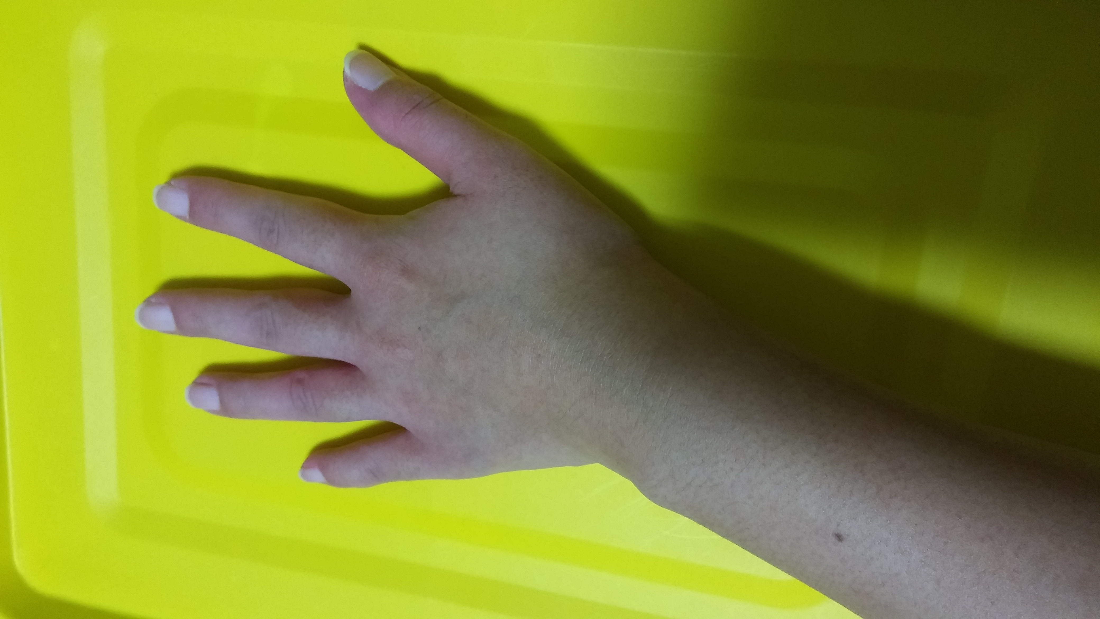 風邪をこじらせました