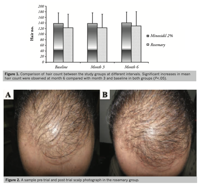 ローズマリー精油は発毛効果があるのか？