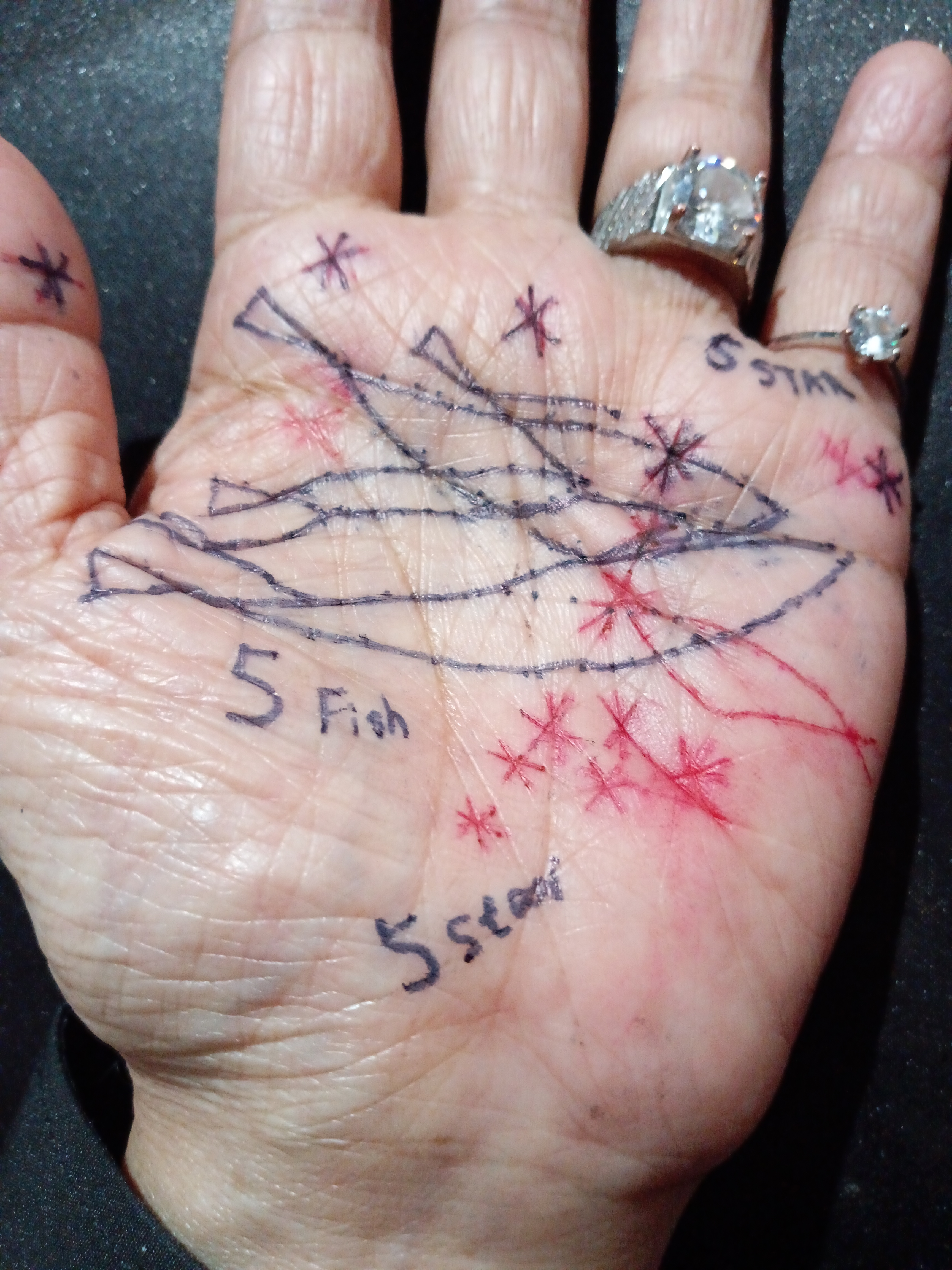 左手に出現した5フィッシュと2種類の5連星(各指の丘と運命線)