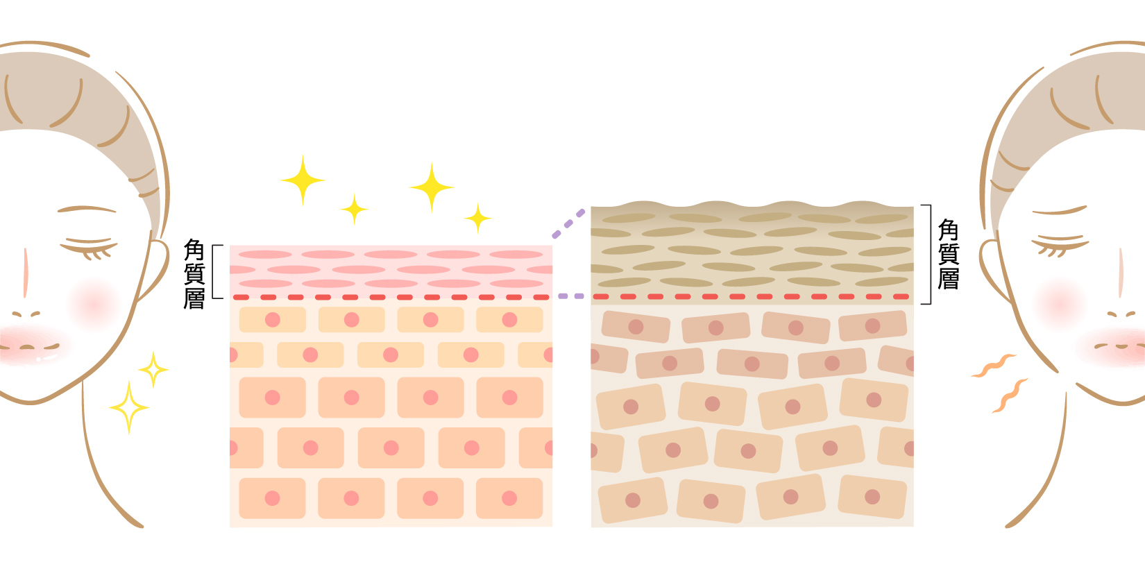 肌悩みの根本解決は「ターンオーバー」が握っている