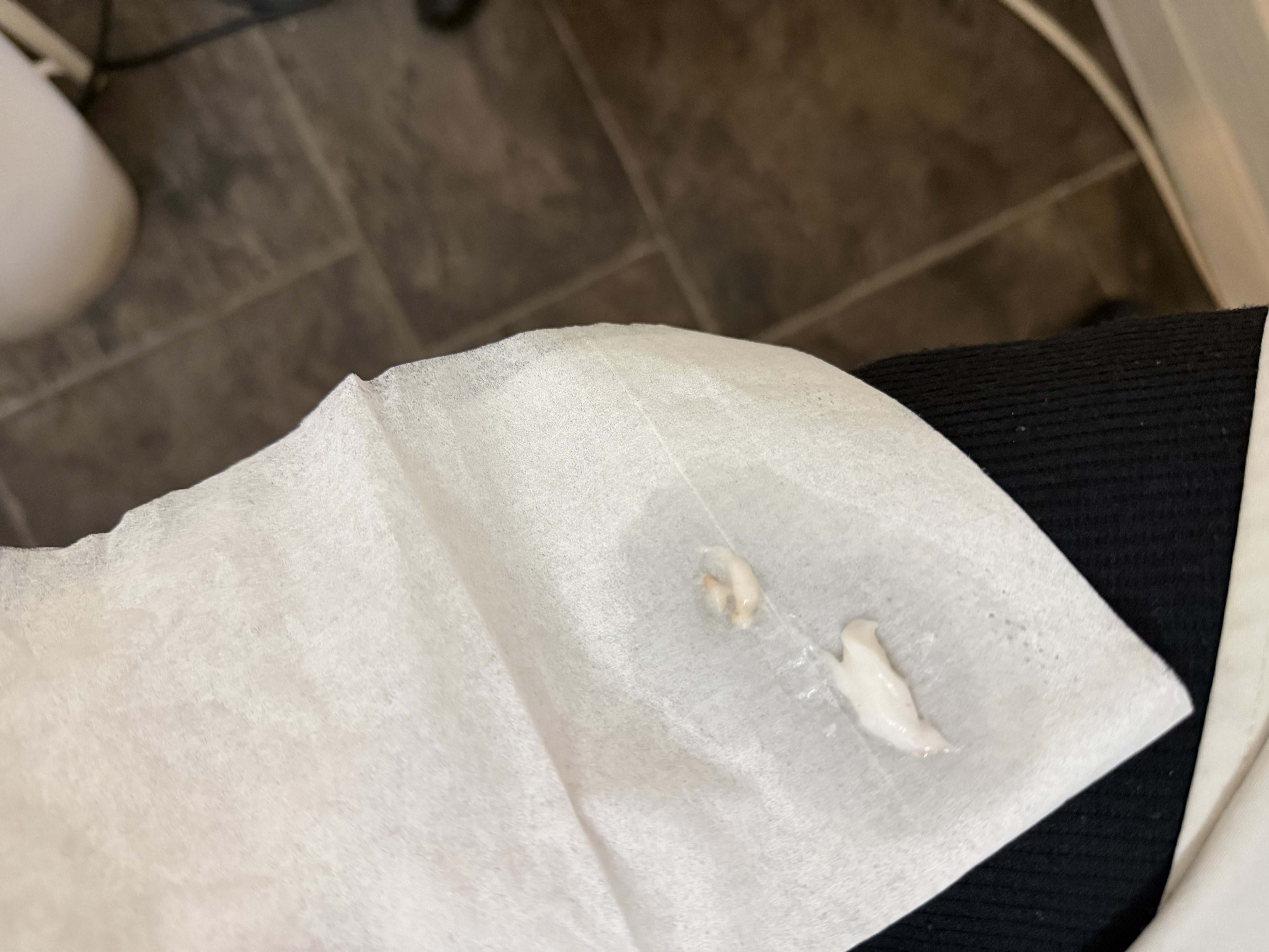 毛穴から脂…
