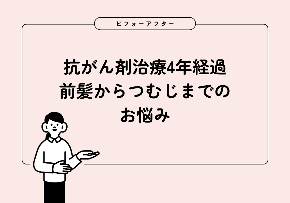 抗がん剤治療から4年。前髪・分け目・後頭部つむじの薄さ悩みビフォーアフター