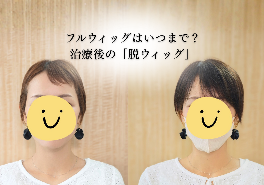 フルウィッグはいつまで?治療後の「脱ウィッグ」はヘアピースへの段階移行が安心です【フル卒】