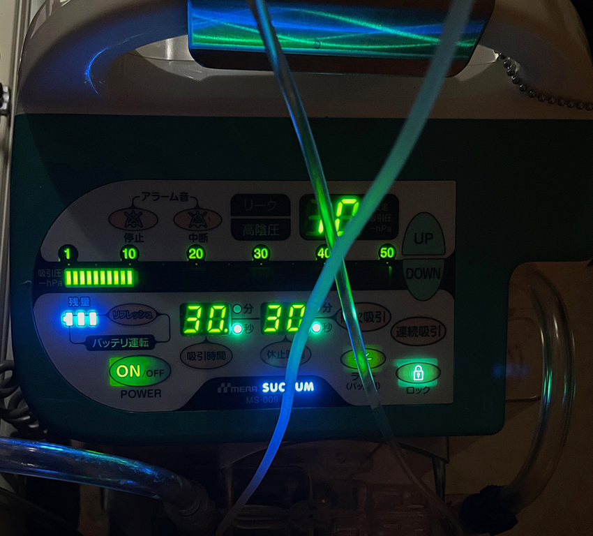 入院記録５　奇蹟的な幸運だったらしい、今回の病気の治療