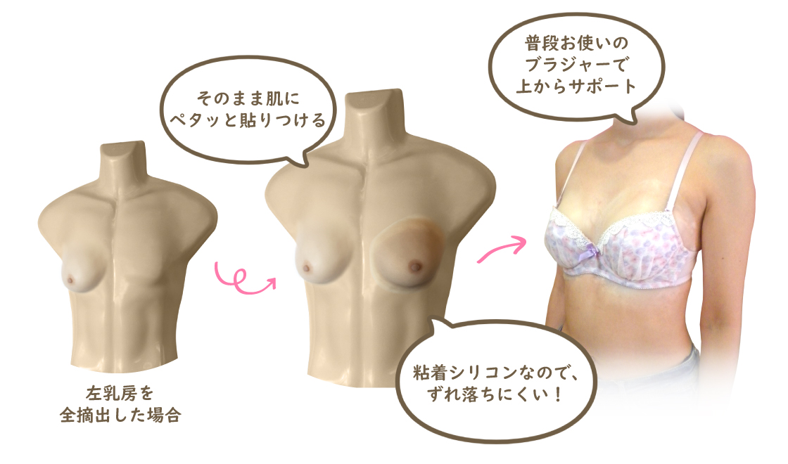 ご自宅で装着式人工乳房がご試着できます（有料）