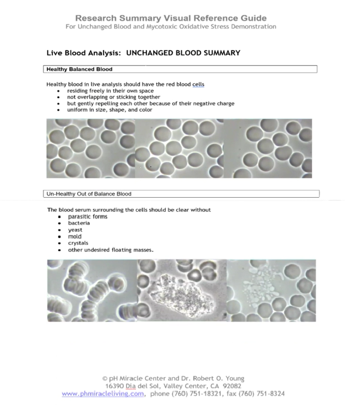 ロバート・O・ヤング博士による：生血液分析・乾燥血液分析レビュー PART 2