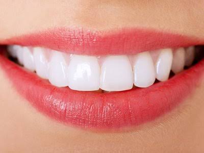 超強力44％で真っ白な歯に！安心のFDA認定商品です！