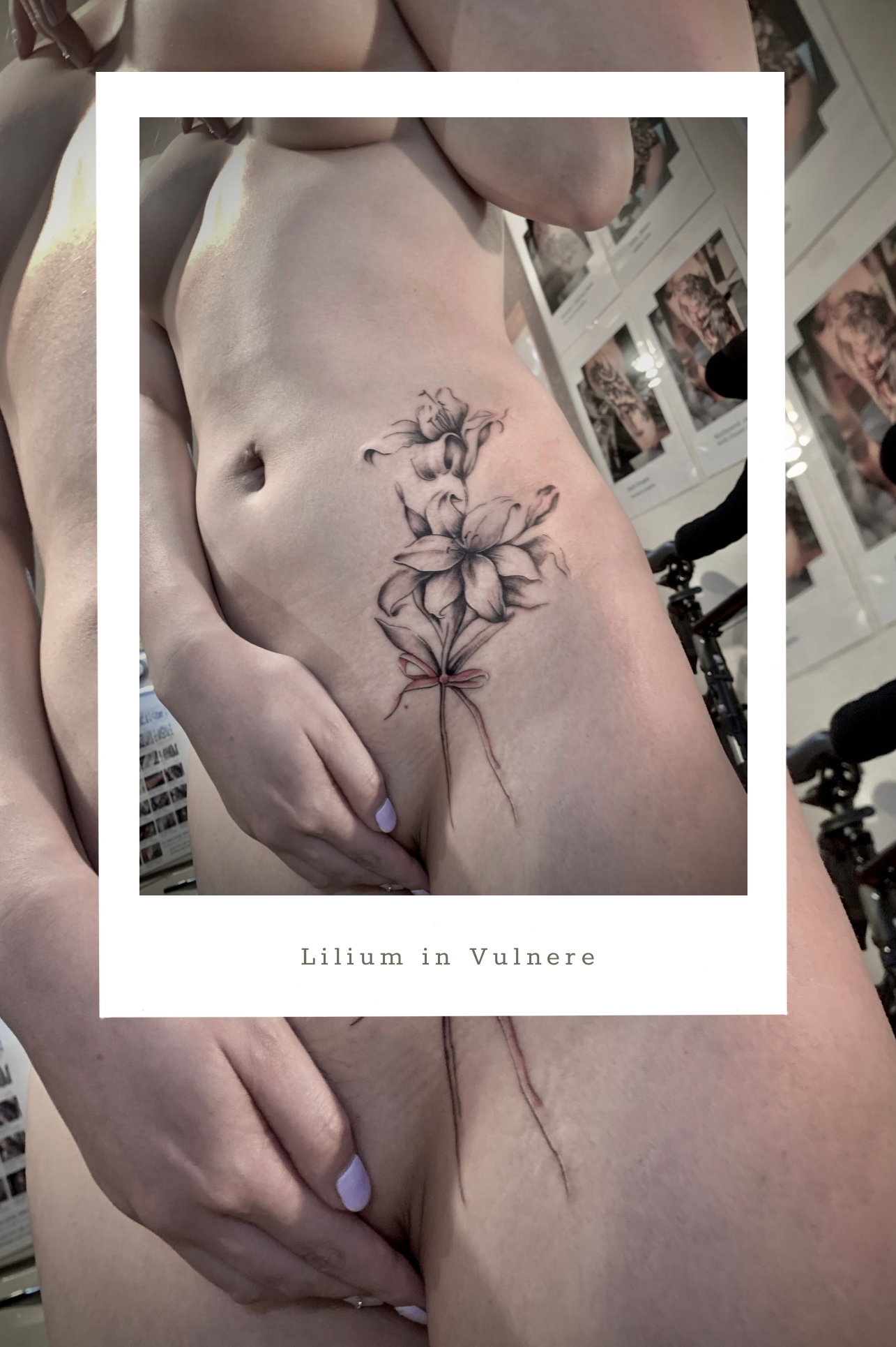 🌑 Petita Sancta No.44 ── Lilium in Vulnere
