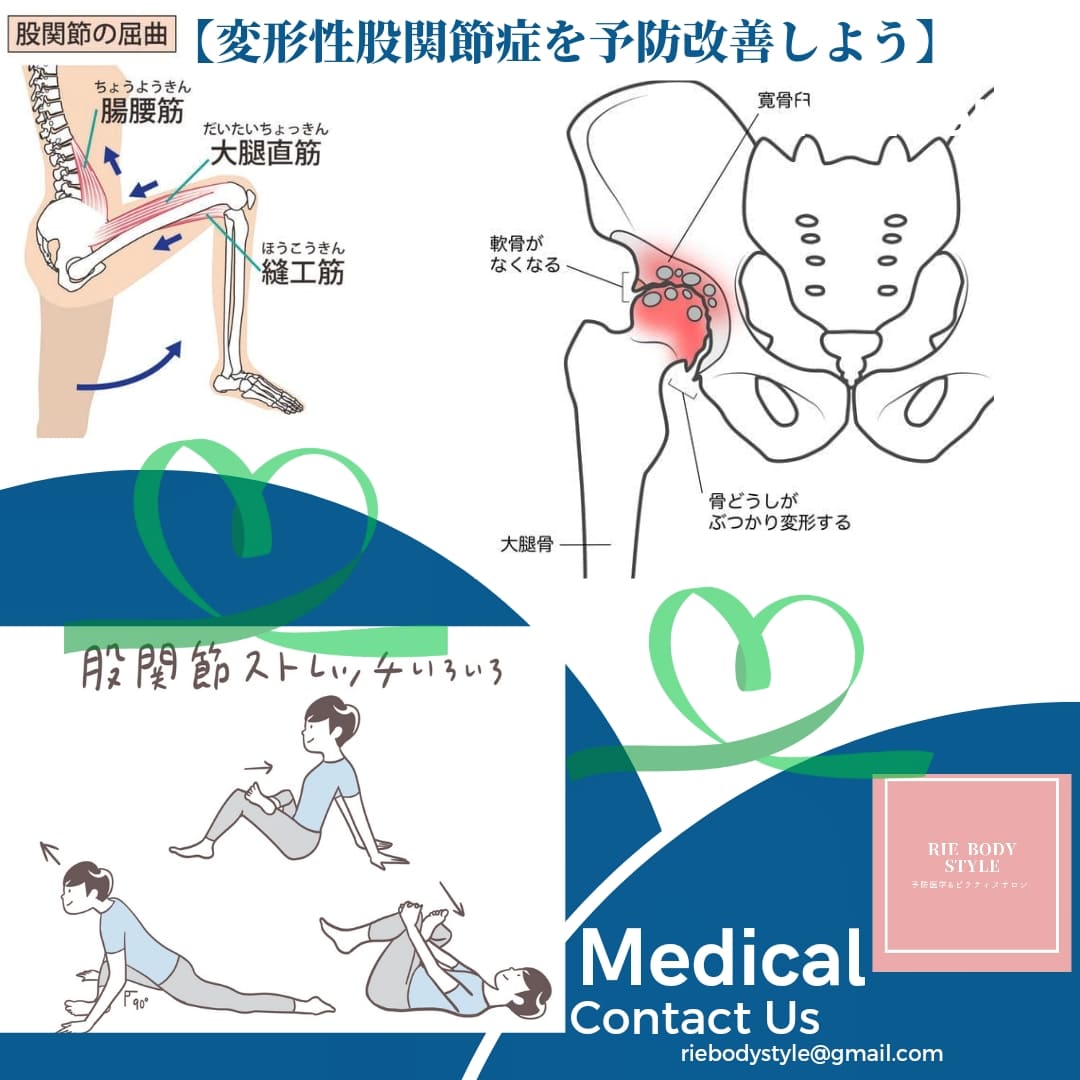 【変形性股関節症を予防改善しよう💚】