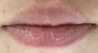 カサカサ唇がプルルン唇に💋