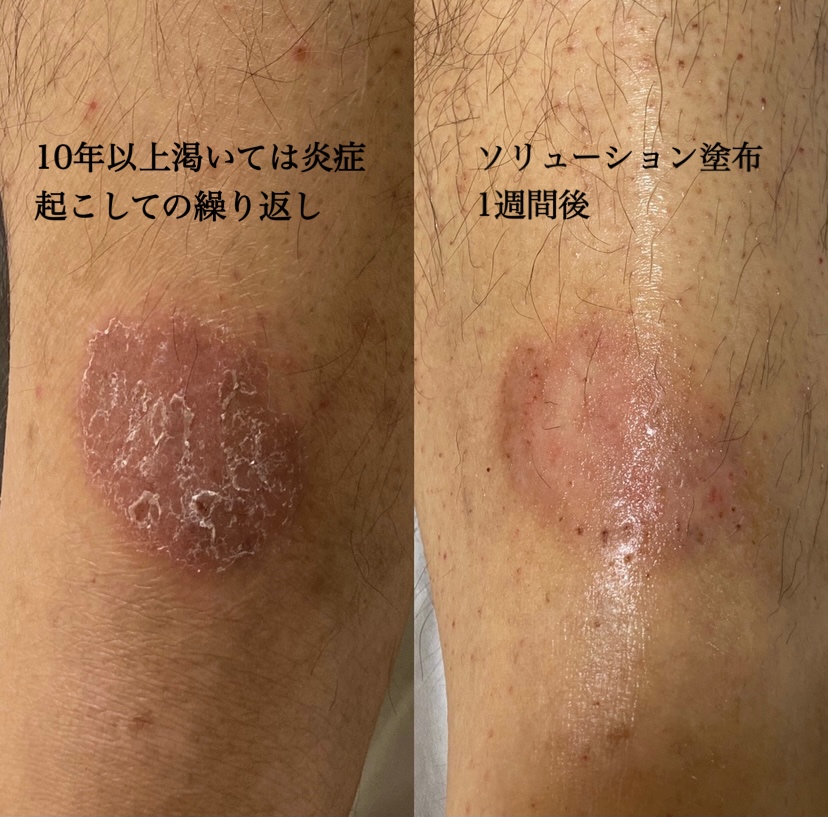 VOS VBソリューションの凄さ‼︎