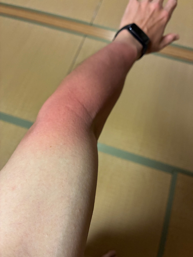 5月の紫外線