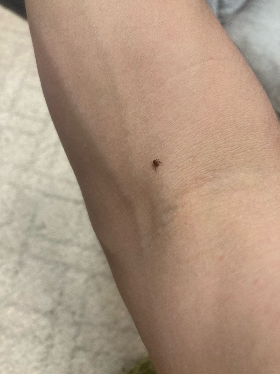 マダニ噛みつかれ名人からの一言