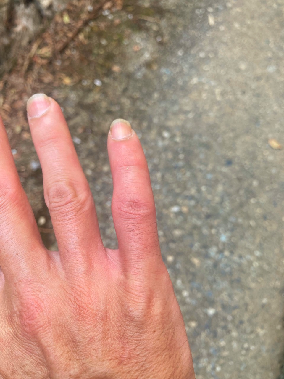 44歳にして、初体験の激痛！