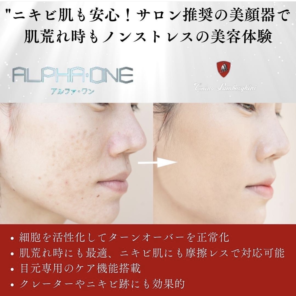 ニキビ肌にも安心でオススメ♡美顔器✨