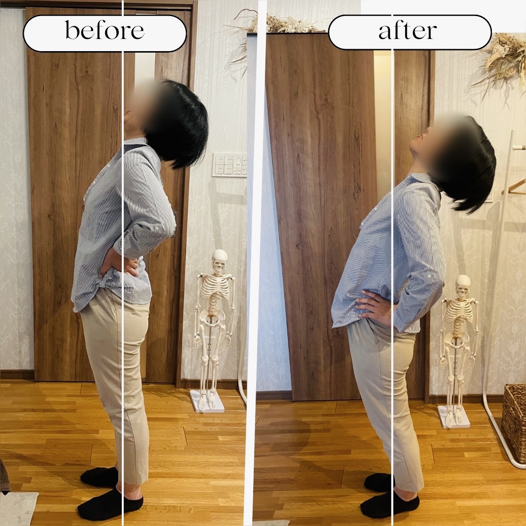 Before & After 施術事例