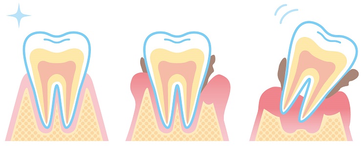 歯と口の健康習慣は炭酸で🦷💋✨