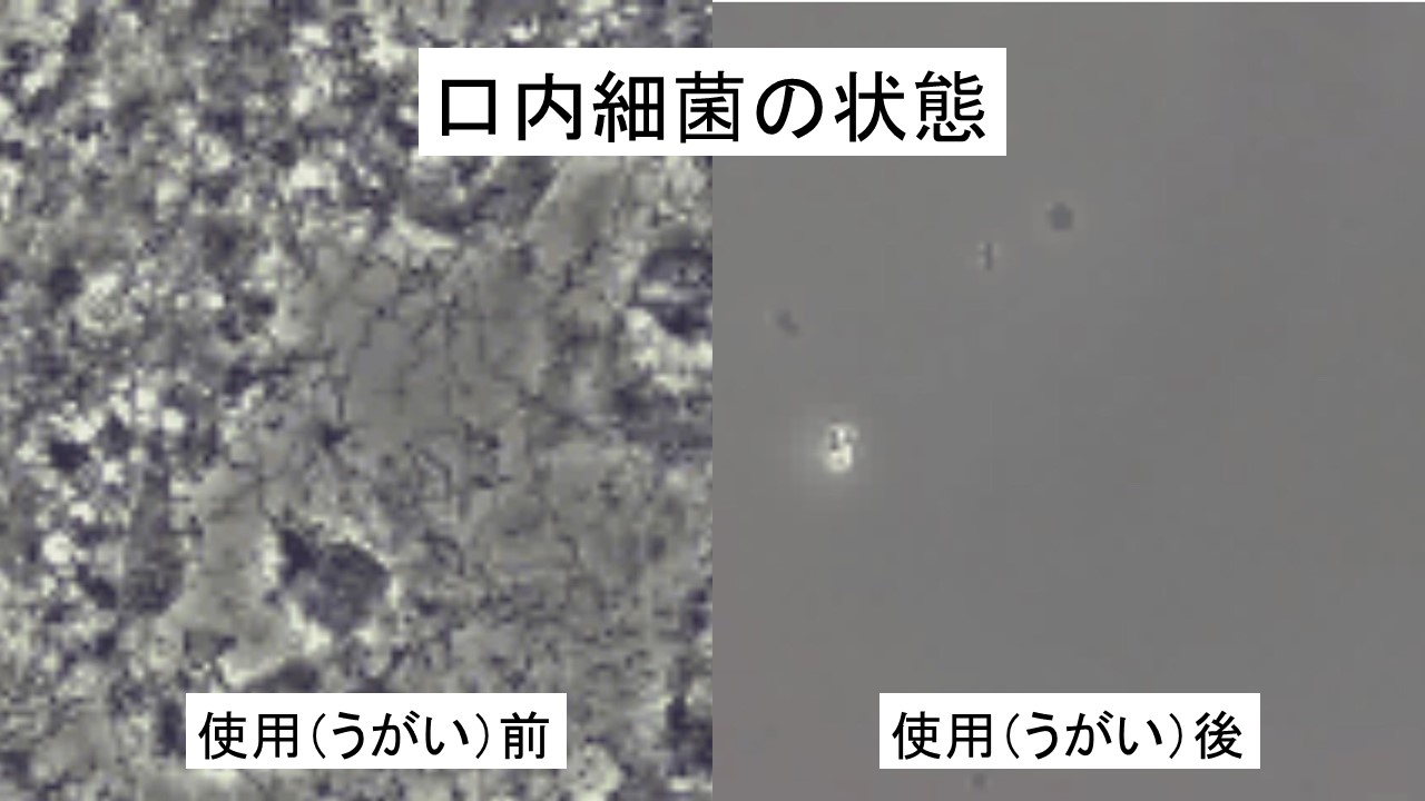 口臭の原因は、、、、⁉️