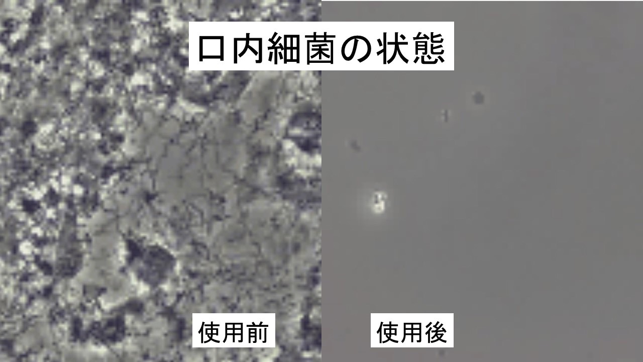 口臭SOSの効果