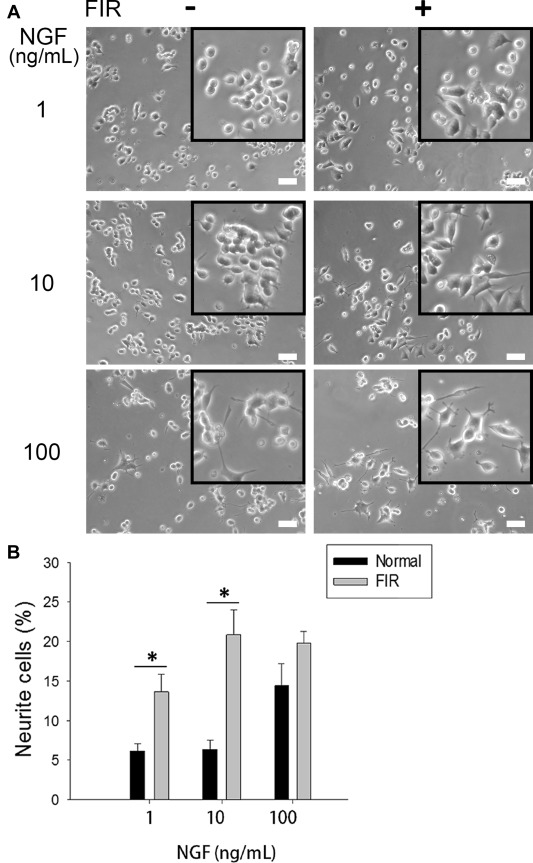 遠赤外線療法で、頭もよくなる?!-驚くべき遠赤外線による神経細胞の成長・神経再生の効果
