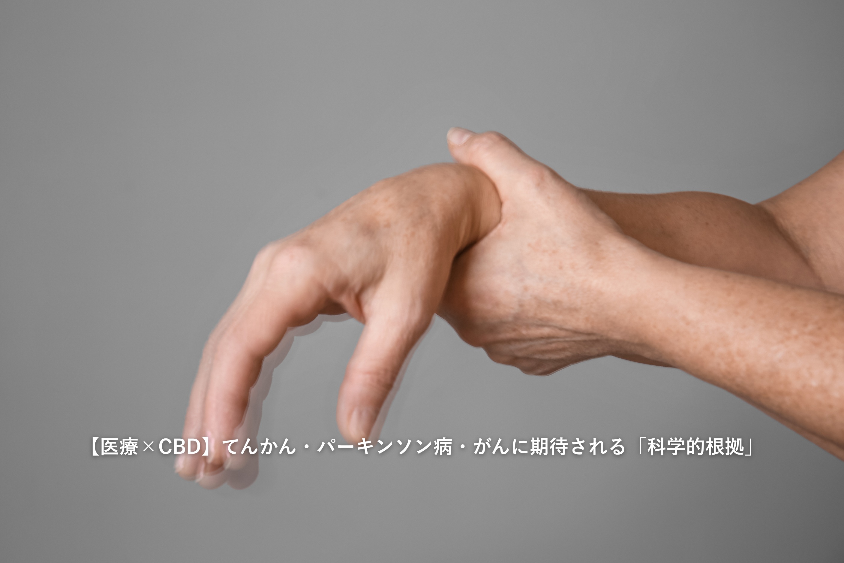 【医療×CBD】てんかん・パーキンソン病・がんに期待される「科学的根拠」