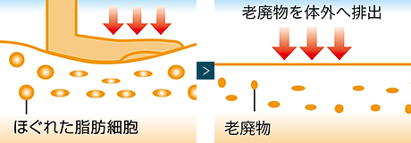 お家でできるセルライト、皮下脂肪撃退　ケア　ハイパーノンエフ クリーム